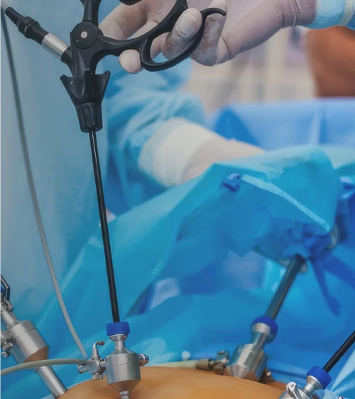 minimal-invasive-surgery